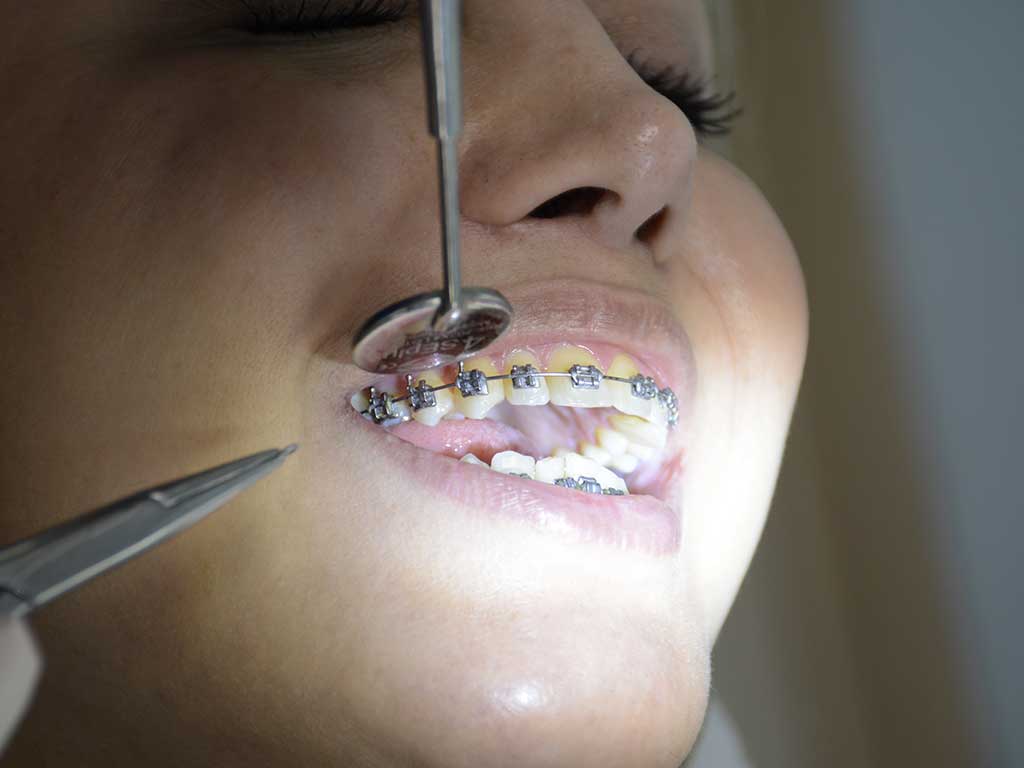 متخصص ارتودنسی - دندانپزشکی غرب تهران