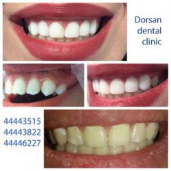 dorsandentalclinic_20200521_5-300x300